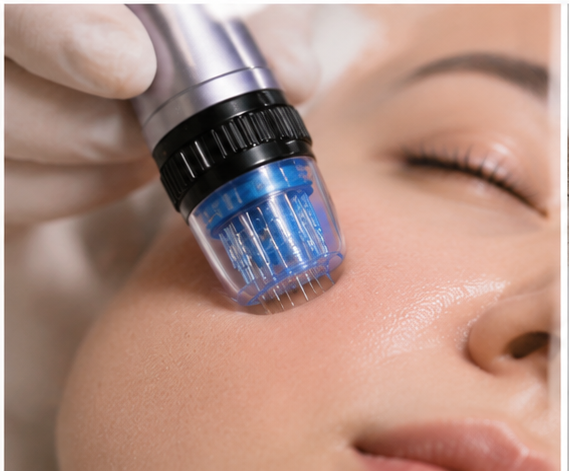 Sylfirm X vs Morpheus8 in Korea: The Ultimate Microneedling RF Comparison